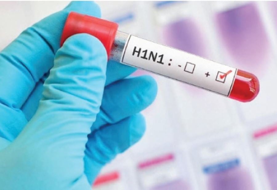 توضيح من "الصحة" بشأن فيروس "H1N1"