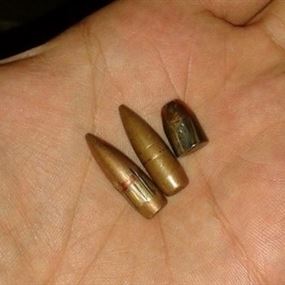 اصابة مواطن برصاصة طائشة في بلدة العين 