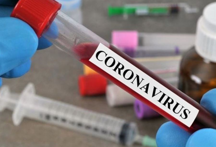 فحوص "PCR" في بعلبك 