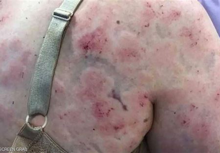 تضحية أم في صورة.. "الظهر الأزرق" يحكي القصة المؤلمة