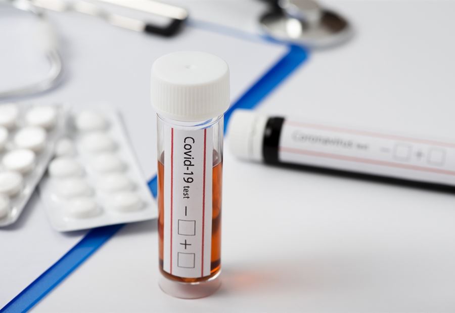 "كورونا" في الدوير ويحمر الشقيف 