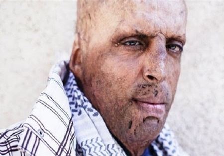 قصة تونسي حاول إحراق نفسه: أشعر بالندم