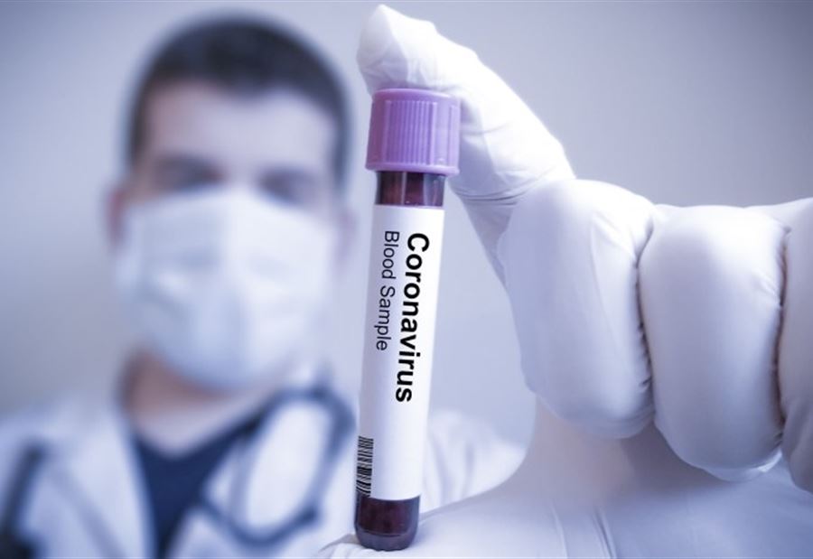 نتائج فحوصات الـ  PCR في الكورة 