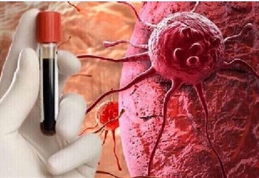 طريقة لكشف سرطان الدم مبكراً!