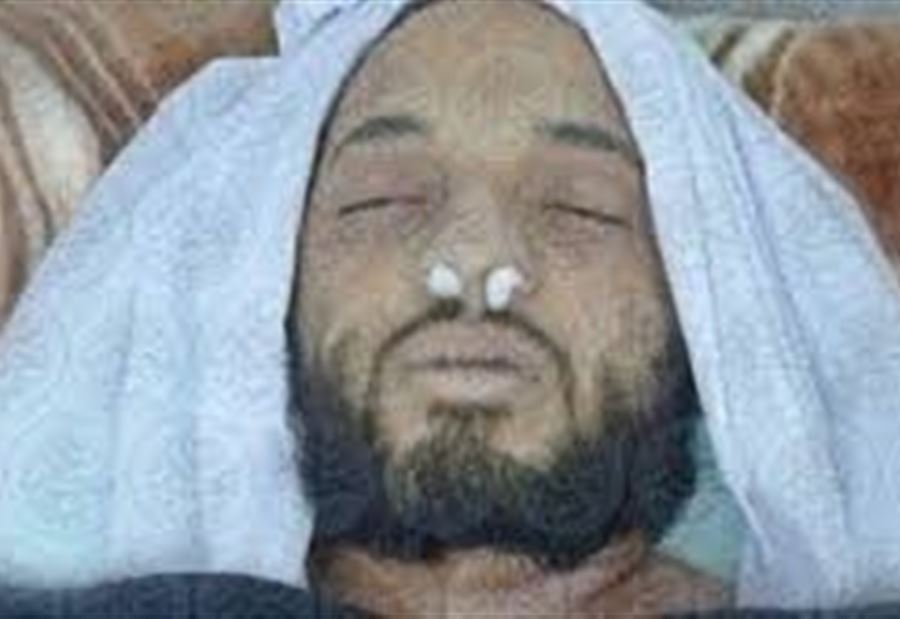بعد إصابته بحروق خطيرة... "سيف العدل" يتوفى في اليمن!