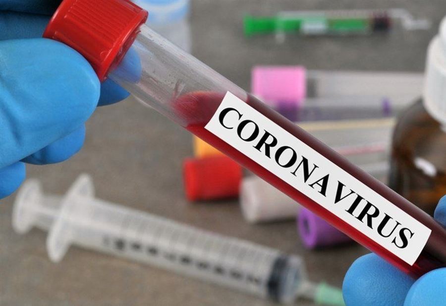 نتائجُ "pcr" ايجابية في أنفه نتائجُ "pcr" ايجابية في أنفه