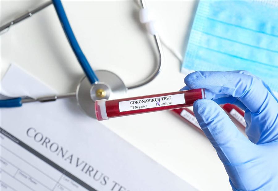 إصاباتٌ جديدة بـ "كورونا" في المنية  إصاباتٌ جديدة بـ "كورونا" في المنية