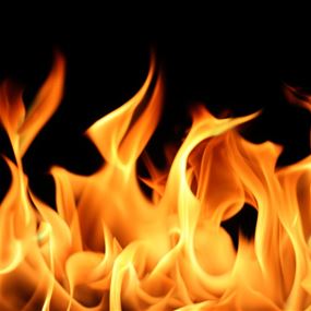 إصابة مواطن حاول إخماد حريق في حديقة منزله إصابة مواطن حاول إخماد حريق في حديقة منزله