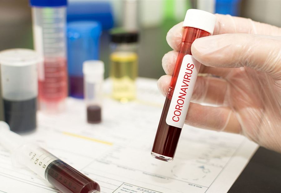 "كورونا" في بلدة الخرايب  "كورونا" في بلدة الخرايب