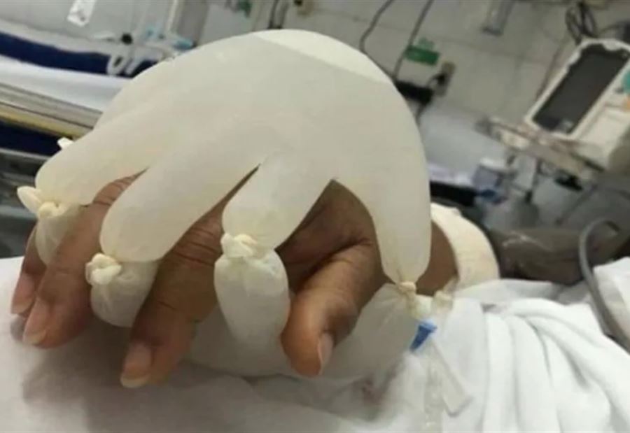في البرازيل... صورة تفطر القلوب لمريضة بكورونا