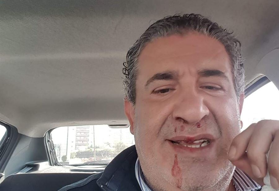 بالصورة: الإعتداء على عضو بلدية سابق
