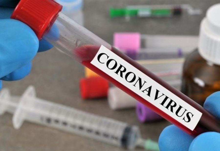 نتائج الـ"PCR" لموظفي كهرباء لبنان - بعبدات  