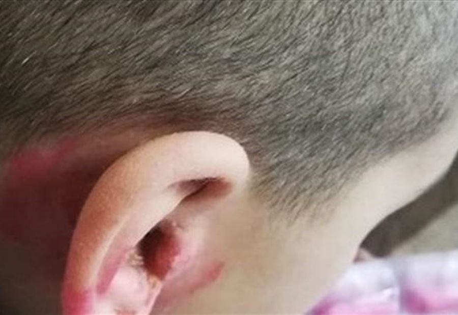 بالصورة: ابنة الـ4 سنوات وشقيقها "ضحية" زوجة والدها