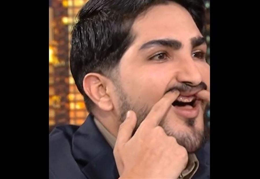 "خسر أسنانه بسبب تسمم الزرنيخ"... منشق عن فيلق القدس "يكشف"! (فيديو)