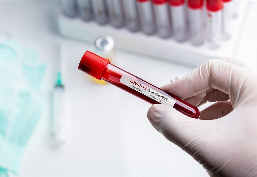 إصابتان بـ"كورونا" في الكفور- تول.. "لا داعي للقلق" إصابتان بـ"كورونا" في الكفور- تول.. "لا داعي للقلق"