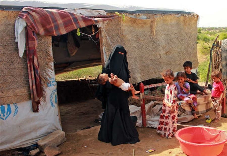"سوء التغذية في اليمن يُهدّد بفقدان جيل كامل"