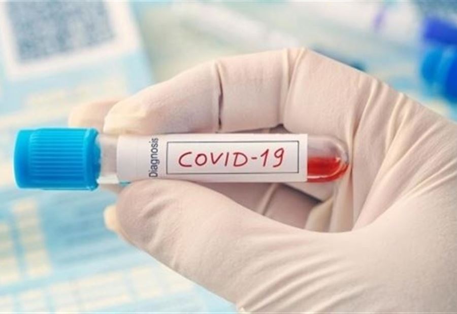 نتائج فحوصات الـ "PCR" لمخالطي مُصاب مجدلون