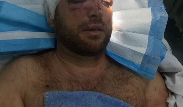 بالصور.. بعد محاولة قتله هذا ما قاله "ستيفن حداد"