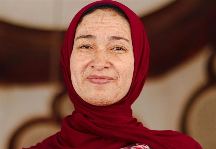 بالصور: مصرية تعاني من مرض يجعلها أكبر بـ3 عقود بالصور: مصرية تعاني من مرض يجعلها أكبر بـ3 عقود
