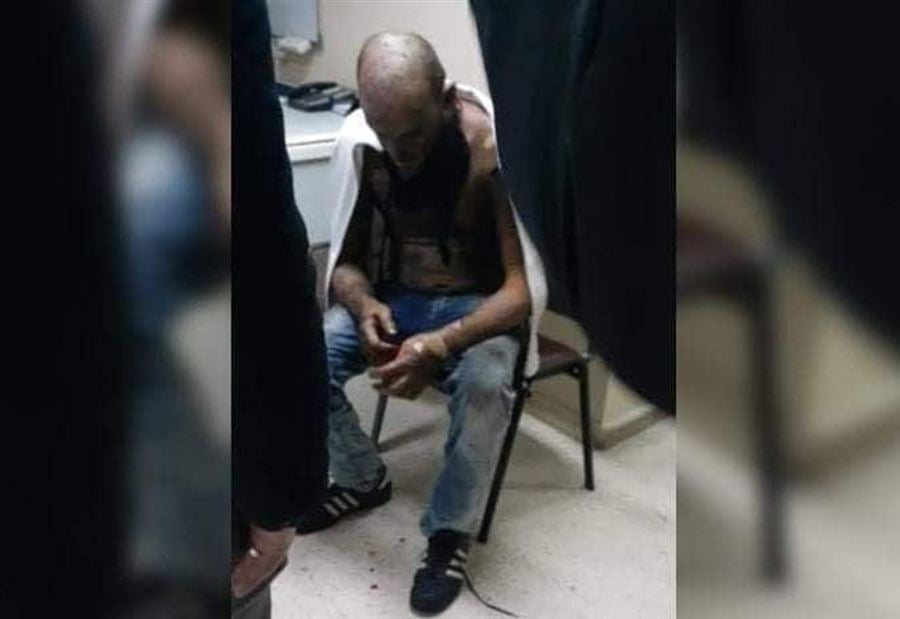 بعد إحراق نفسه في طرابلس... هيثم النيز فارق الحياة