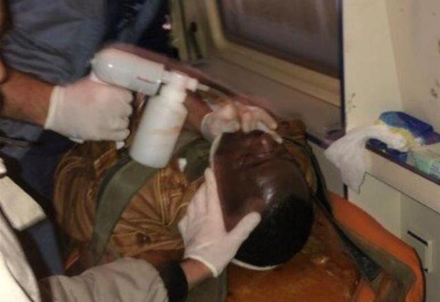 أصيب اثر صدمه في منطقة صور أصيب اثر صدمه في منطقة صور