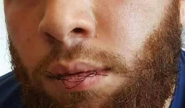 بالصور.. سُجناء "قطبوا" فمهم