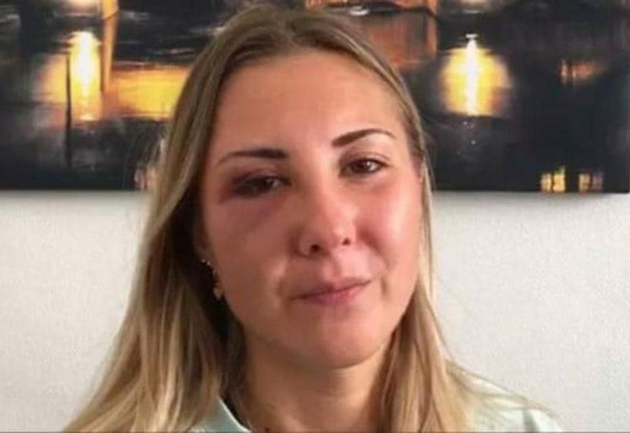 اعتداءٌ مشينٌ في قلب مدينة فرنسية... والسبب "تنورة" اعتداءٌ مشينٌ في قلب مدينة فرنسية... والسبب "تنورة"
