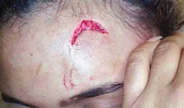 بالصور.. هذا ما فعلته السيدة الأولى بعارضة أزياء