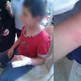 بالصورة.. معلمة تكسر إصبع تلميذها في طرابلس