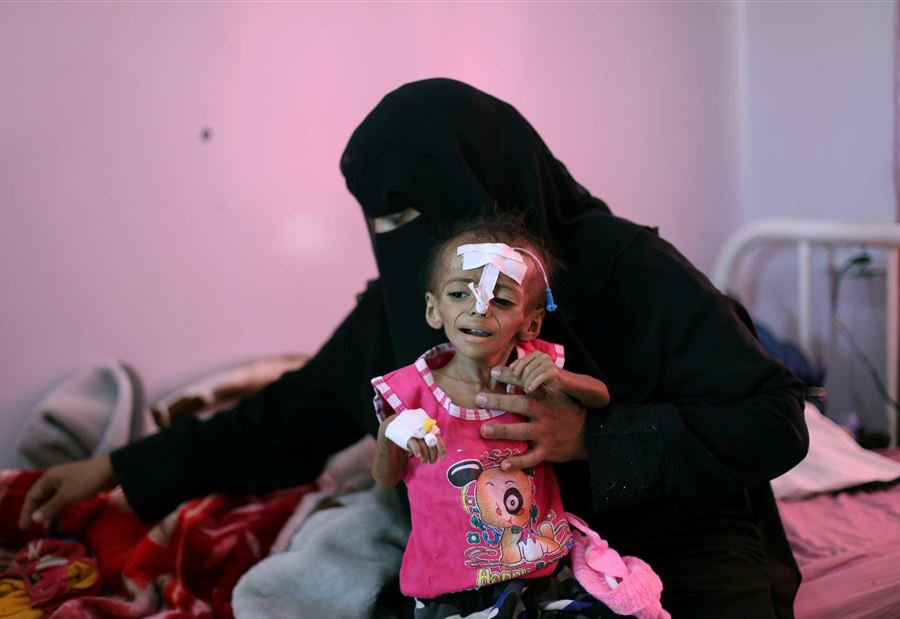 "العد التنازلي للكارثة بدأ"... اليمن على أبواب المجاعة "العد التنازلي للكارثة بدأ"... اليمن على أبواب المجاعة