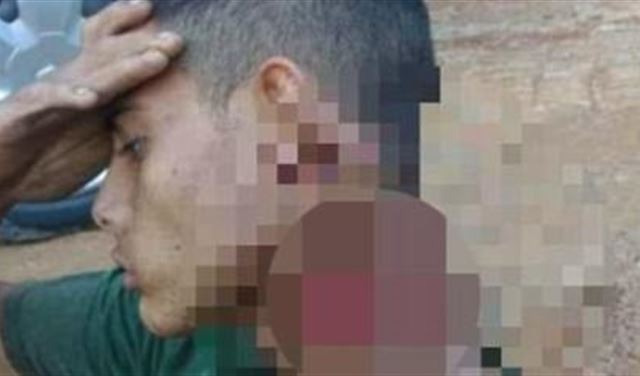 حمل رأسه شبه المقطوع مئات الأمتار.. وأنقذ نفسه