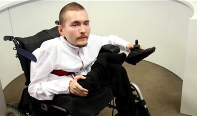 جراحون يعتزمون زراعة رأس بشري على متطوع 