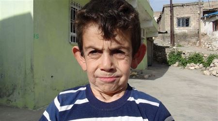 بالصورة.. طفل سوري تحسبه رجلاً مسناً!