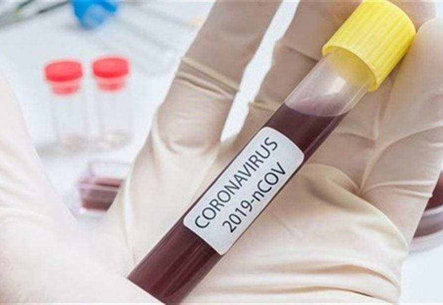 صدور فحوص PCR لـ 65 فردًا في برج حمود 