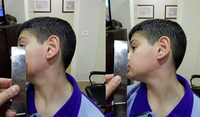 بعد تعرض تلميذهم للضرب...مدرسة الأنطونية توضح!  بعد تعرض تلميذهم للضرب...مدرسة الأنطونية توضح!