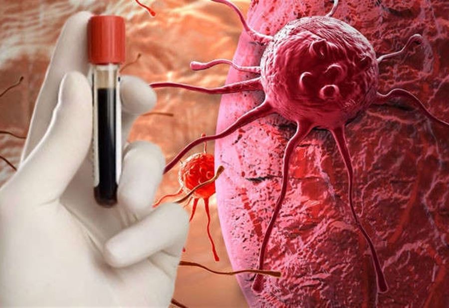 ابتكار مستحضر آمن وفعال لعلاج السرطان ابتكار مستحضر آمن وفعال لعلاج السرطان