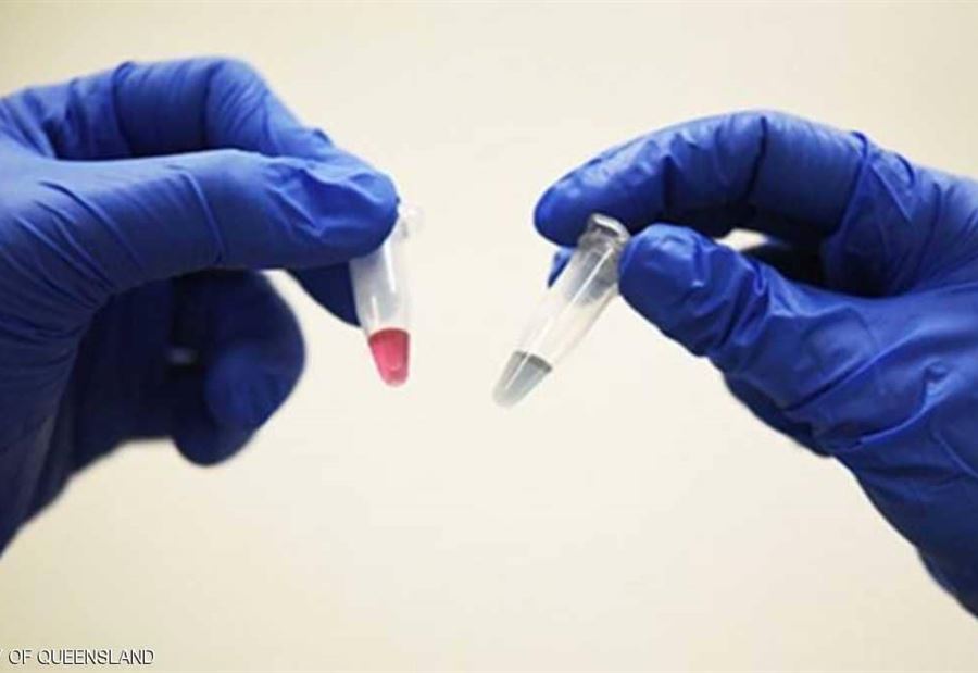 اختبار يكشف الإصابة بالسرطان في 10 دقائق