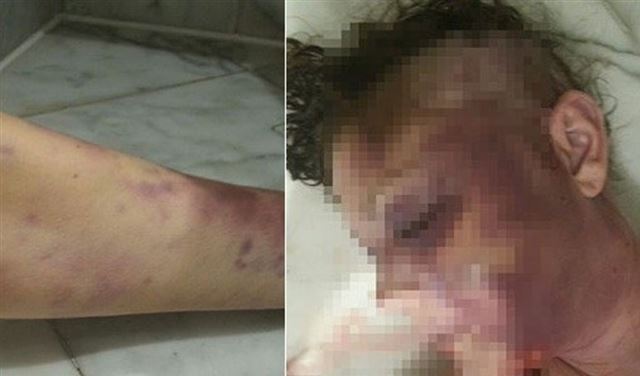 جريمة مروعة داخل فندق شهير..والضحية حامل! 