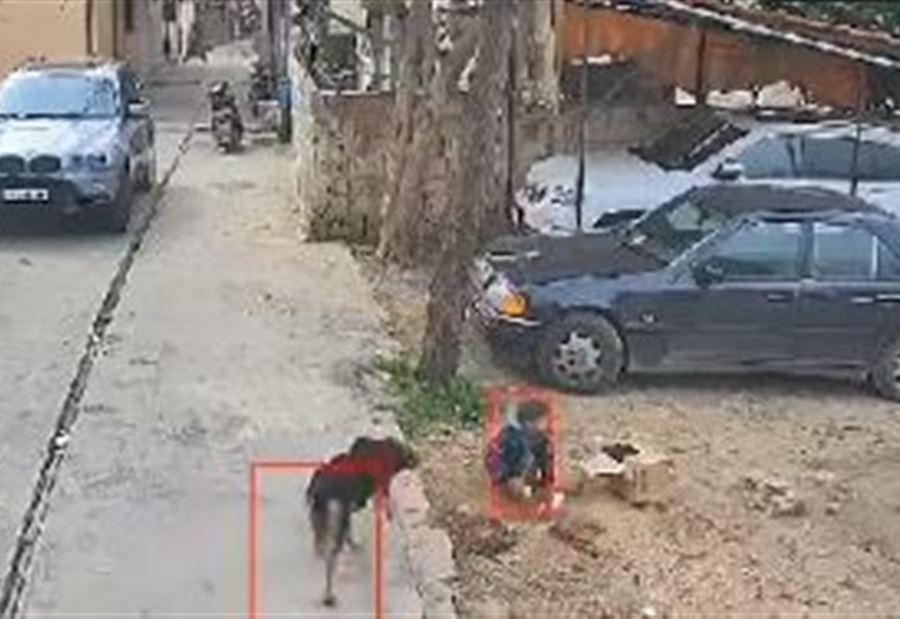 فيديو "مؤلم"... كلب مسعور يقضي على حياة طفل! 