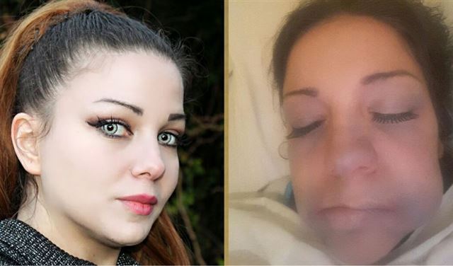 وجه تينا زبيدي لم يشوهّه التجميل.. واليكم الحقيقة كاملة!