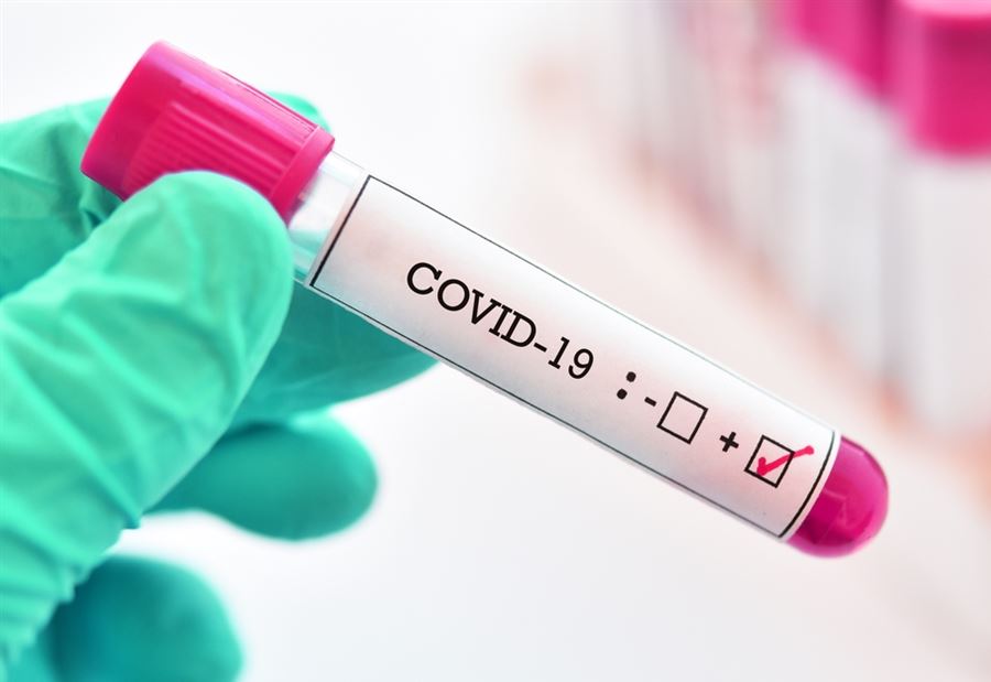 "كورونا".. بيانٌ توضيحي لـ "جامعة العائلة المقدسة" "كورونا".. بيانٌ توضيحي لـ "جامعة العائلة المقدسة"