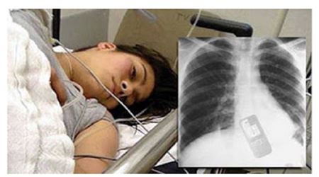 مراهقة تبتلع هاتفها الجوال والسبب..!