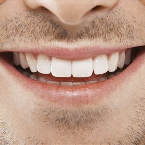  نوّاب الـHollywood Smile والتجميل