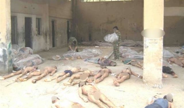 طالبة طب سورية تتفاجأ بجثة أخيها على طاولة التشريح