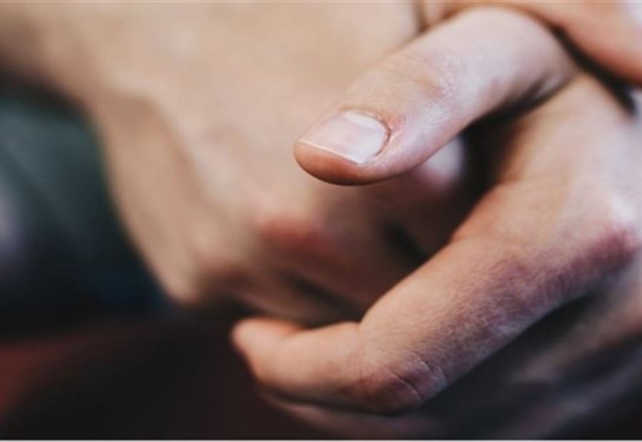 "تغيّرات" في الأظافر قد تشير إلى الإصابة بمرض الكبد الدهني! 