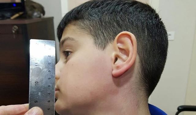 خاص- في الأنطونية..المعلمة تضرب تلميذاً والمعلمة طُردت! 