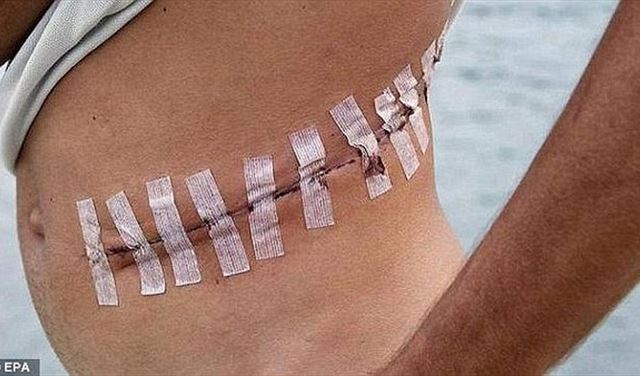 أبشع طرق داعش لبيع أعضاء بشرية بمساعدة أطباء أجانب