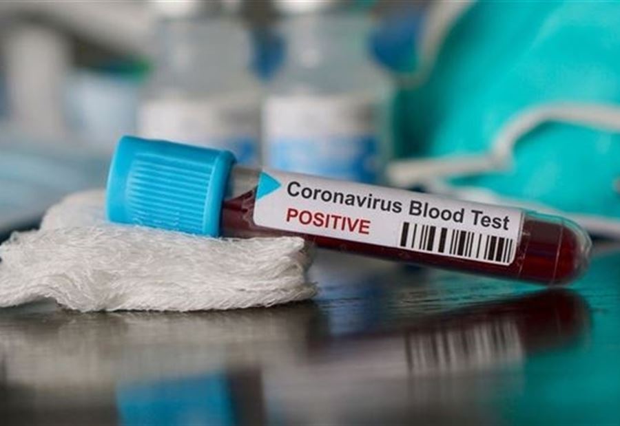 إليكم إصابات ووفيات كورونا الجديدة في لبنان!