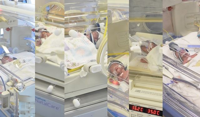 حالة عالمية نادرة أم حامل طبيعيا ب6 توائم حالة عالمية نادرة أم حامل طبيعيا ب6 توائم