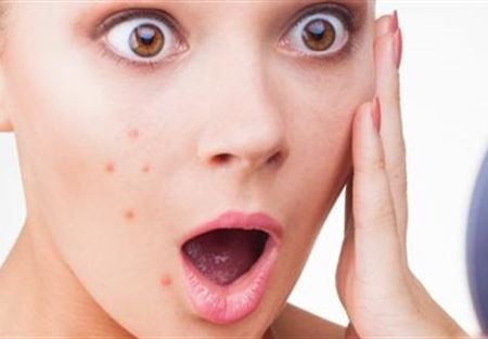 7طرق تمنع ظهور حبوب الوجه